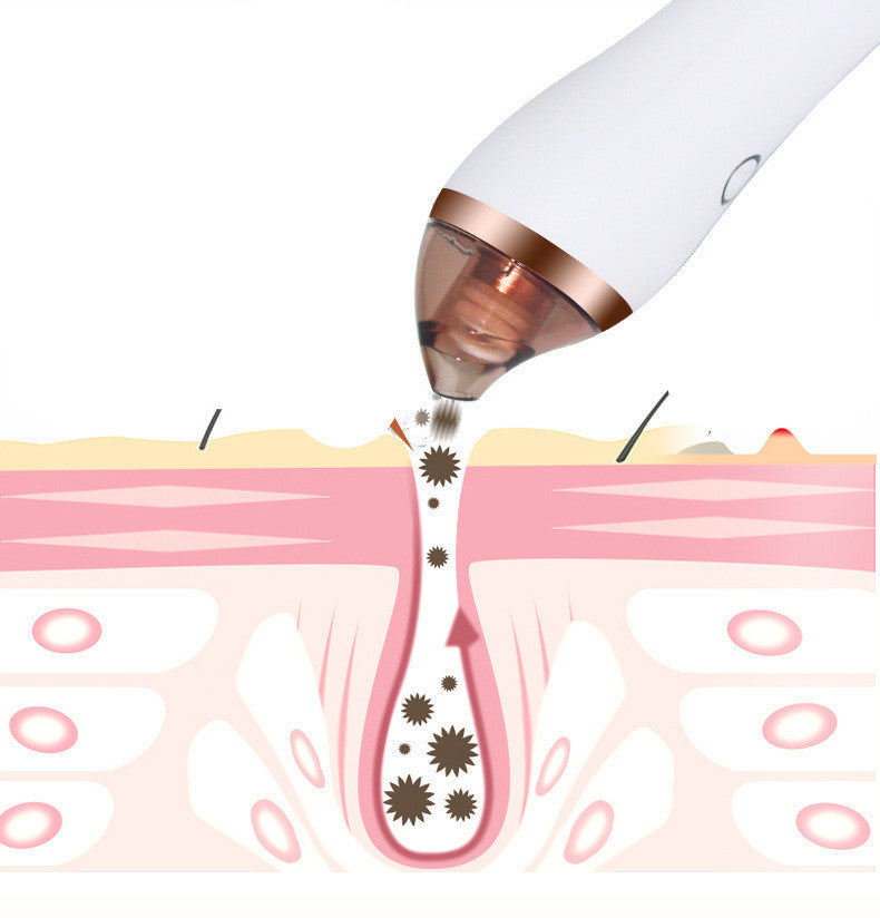4 in 1 Body Guasha Cupping Blackhead Remover Machine Facial Pore Deep Cleansing Beauty Skin Care - Ectron Online