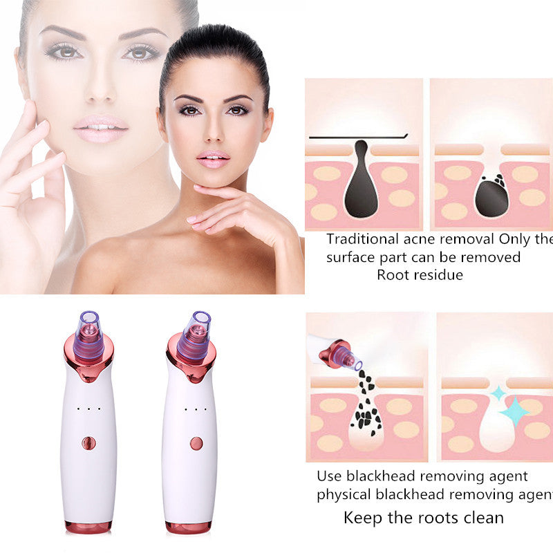 Blackhead Remover Instrument Black Dot Remover Acne Vacuum Suction Face Clean Black Head Pore Cleaning Beauty Skin Care Tool - Ectron Online