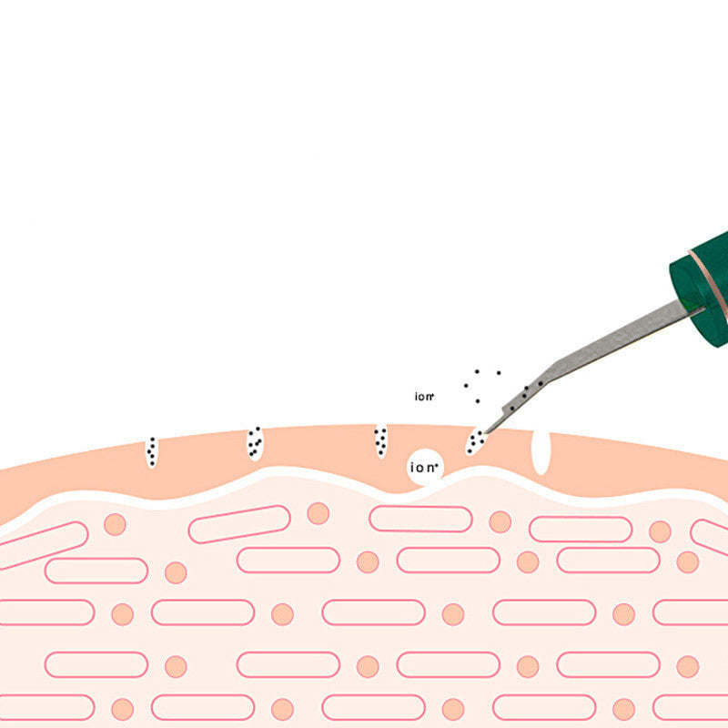 Ultrasonic Skin Rejuvenation Whitening Shoveling Machine Exfoliating Skin Care - Ectron Online