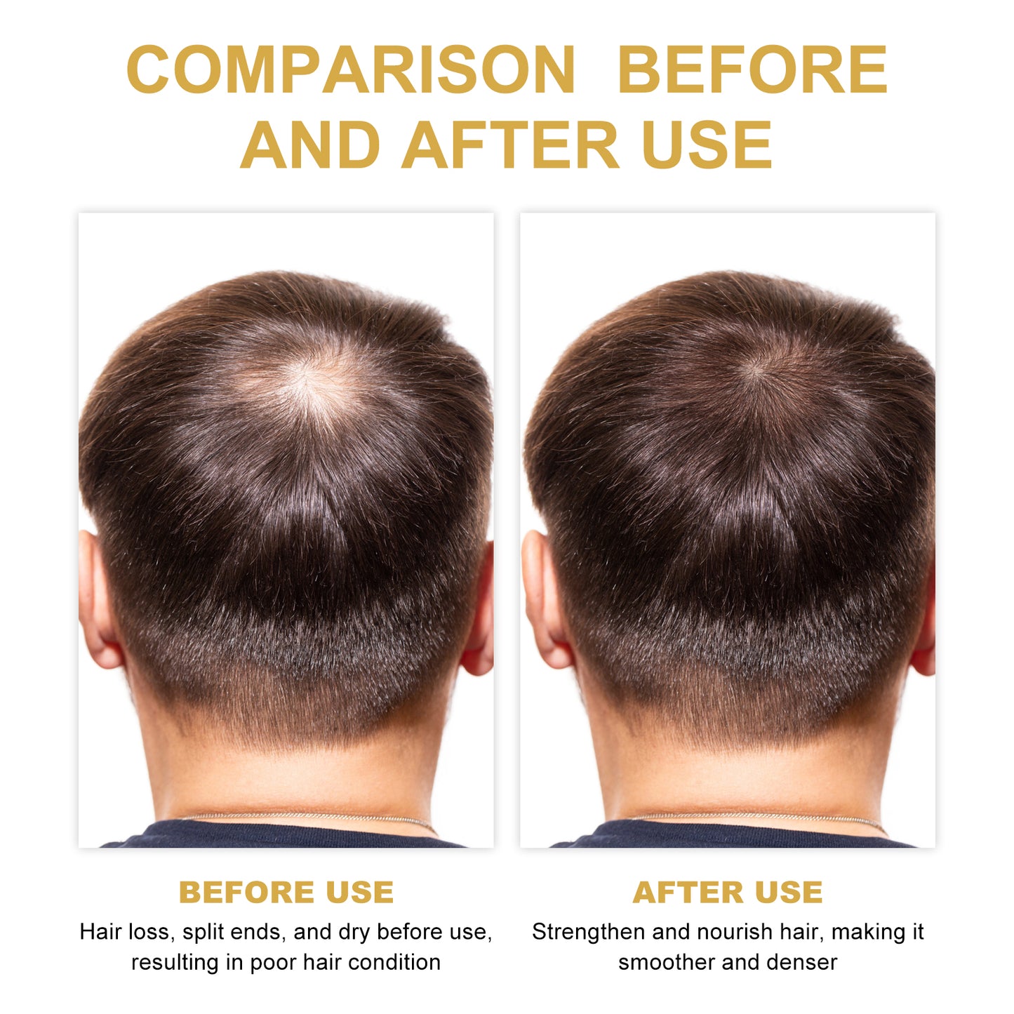 EELHOE Rosemary Hair Oil - Growth & Scalp Treatment (30ml)