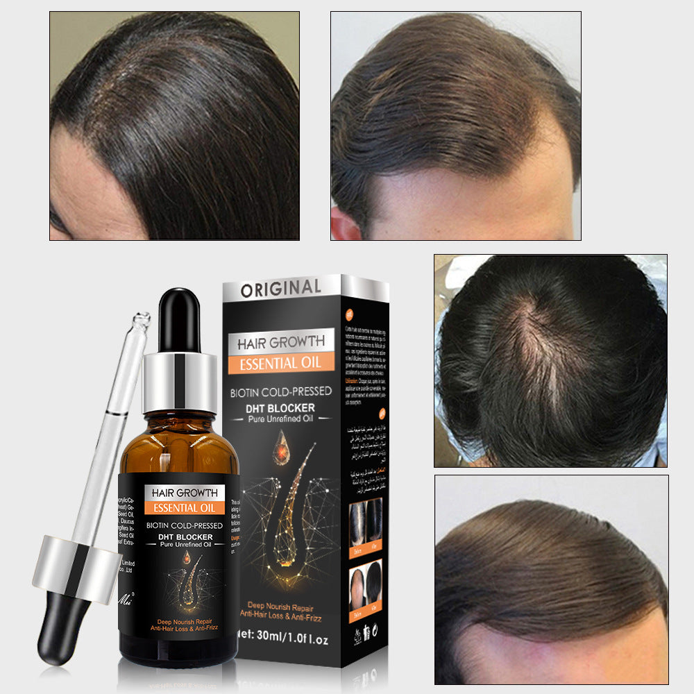 Hair growth essential oil with packaging and before-and-after hair health comparisons.