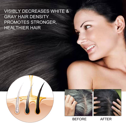 EELHOE Hair Dense Essence EELHOE Hair Dense Essence Hair Anti-hair | Ectron Online
