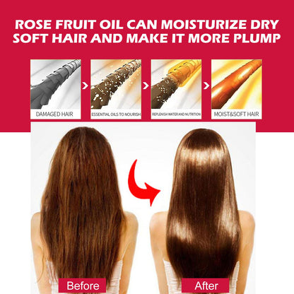 EELHOE Rosehip Facial Oil - Multi-Use Body, Hair & Massage Serum EELHOE Rosehip Facial Oil For Facial And | Ectron Online