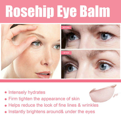 Rose Fruit Eye Cream Stick Fade Fine Lines Of Eye Bags