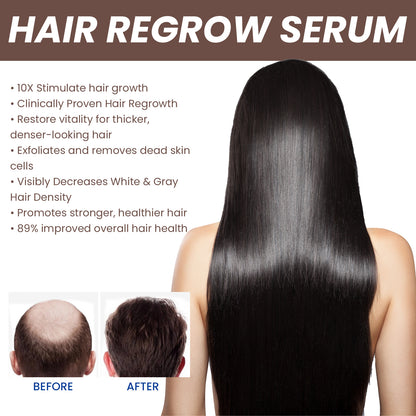 EELHOE Hair Dense Essence EELHOE Hair Dense Essence Hair Anti-hair | Ectron Online