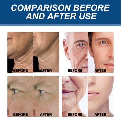 East Moon Collagen Cream East Moon Collagen Cream, Fade Fine Line | Ectron Online