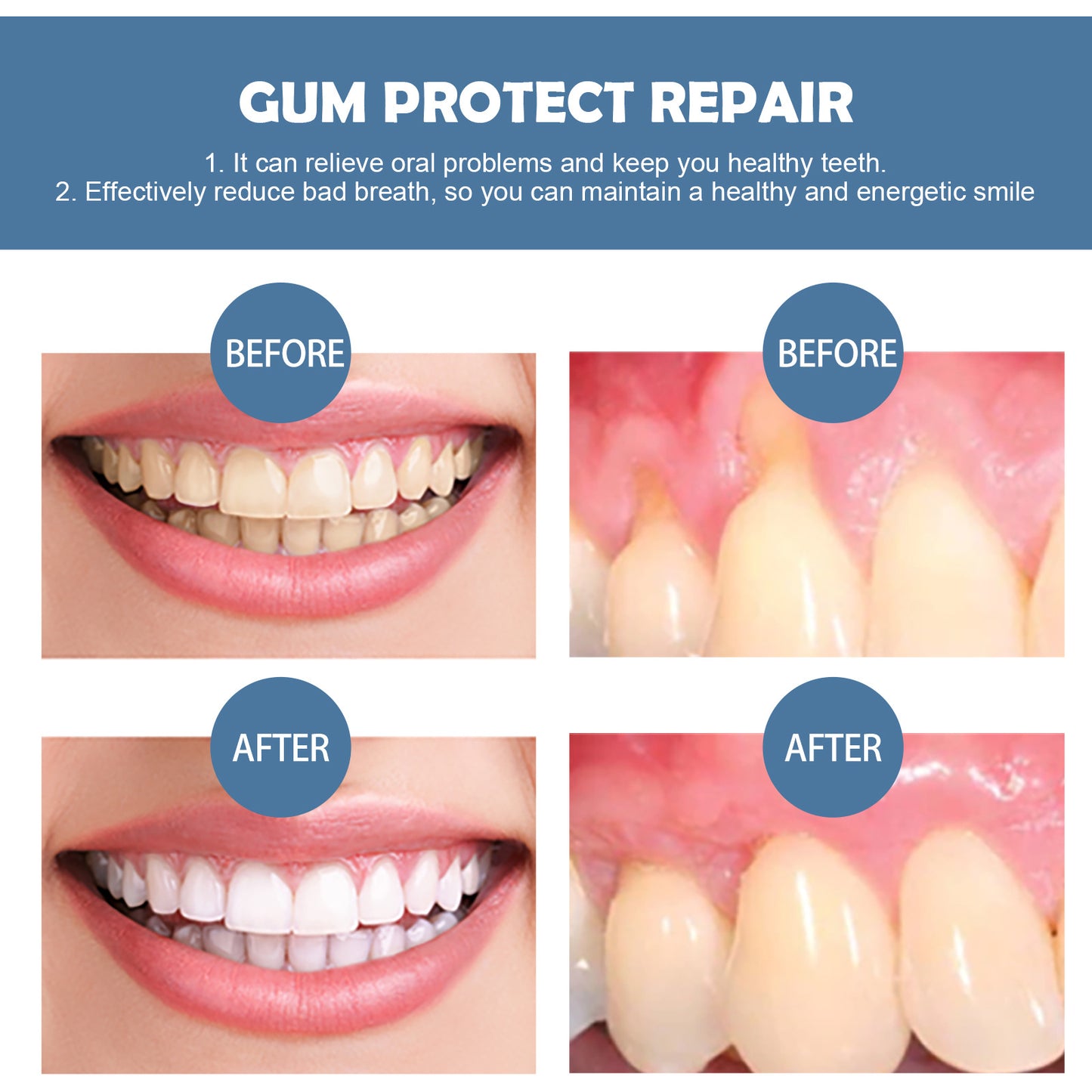 EELHOE Gum Repair Series - Deep Cleaning & Gum Regrowth Treatment