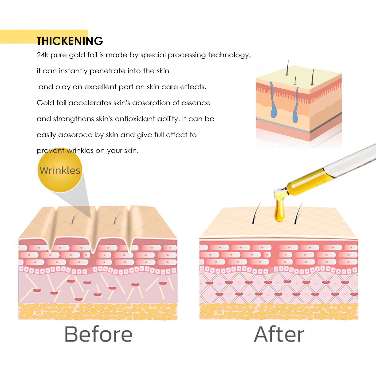 24K Gold Collagen Protein Thread Lift - Instant Face Firming Set