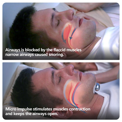 Smart Anti Snoring Device - Electronic Muscle Stimulator Pro - Sleep Smart Anti Snoring Device Electronic Mus | Ectron Online