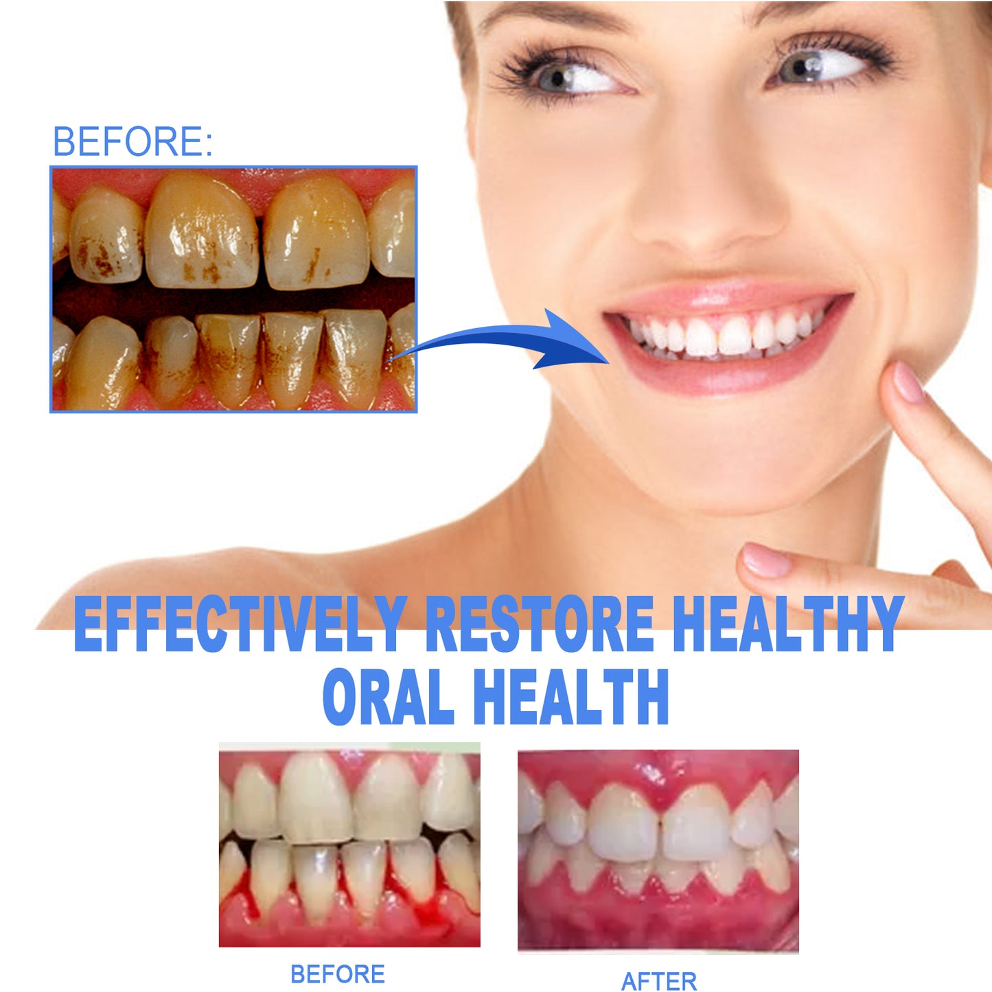 EELHOE Dental Repair Gel