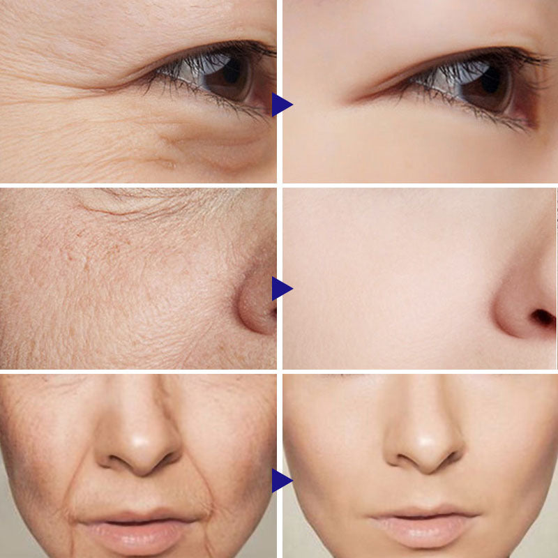 Before and after comparison of facial skin texture and aging on a person's face.