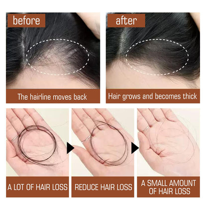 Raw Batana Oil from Honduras - Natural Hair Growth & Repair Treatment Batana Oil From Honduras - Get Fuller, T | Ectron Online