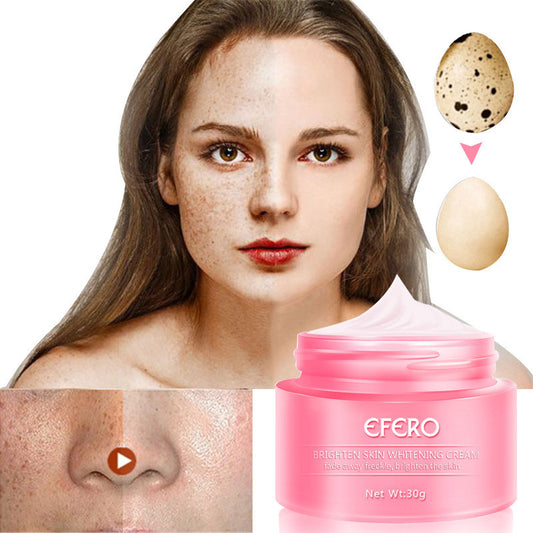 Efero freckle cream - Ectron Online