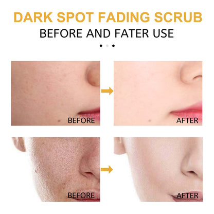 Eelhoe Turmeric Facial Scrub Eelhoe Turmeric Exfoliating Facial Scrub | Ectron Online