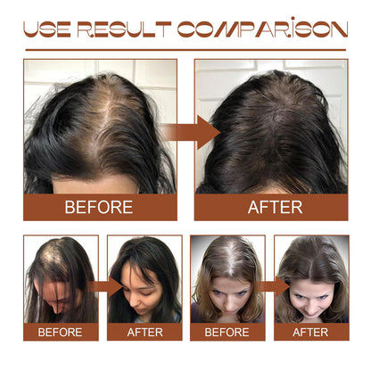 Raw Batana Oil from Honduras - Natural Hair Growth & Repair Treatment Batana Oil From Honduras - Get Fuller, T | Ectron Online