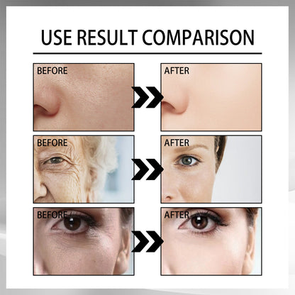 Snail Repair Anti-Aging Cream - Firming & Wrinkle Replenishment Snail Cream Fading Wrinkle French Lines | Ectron Online