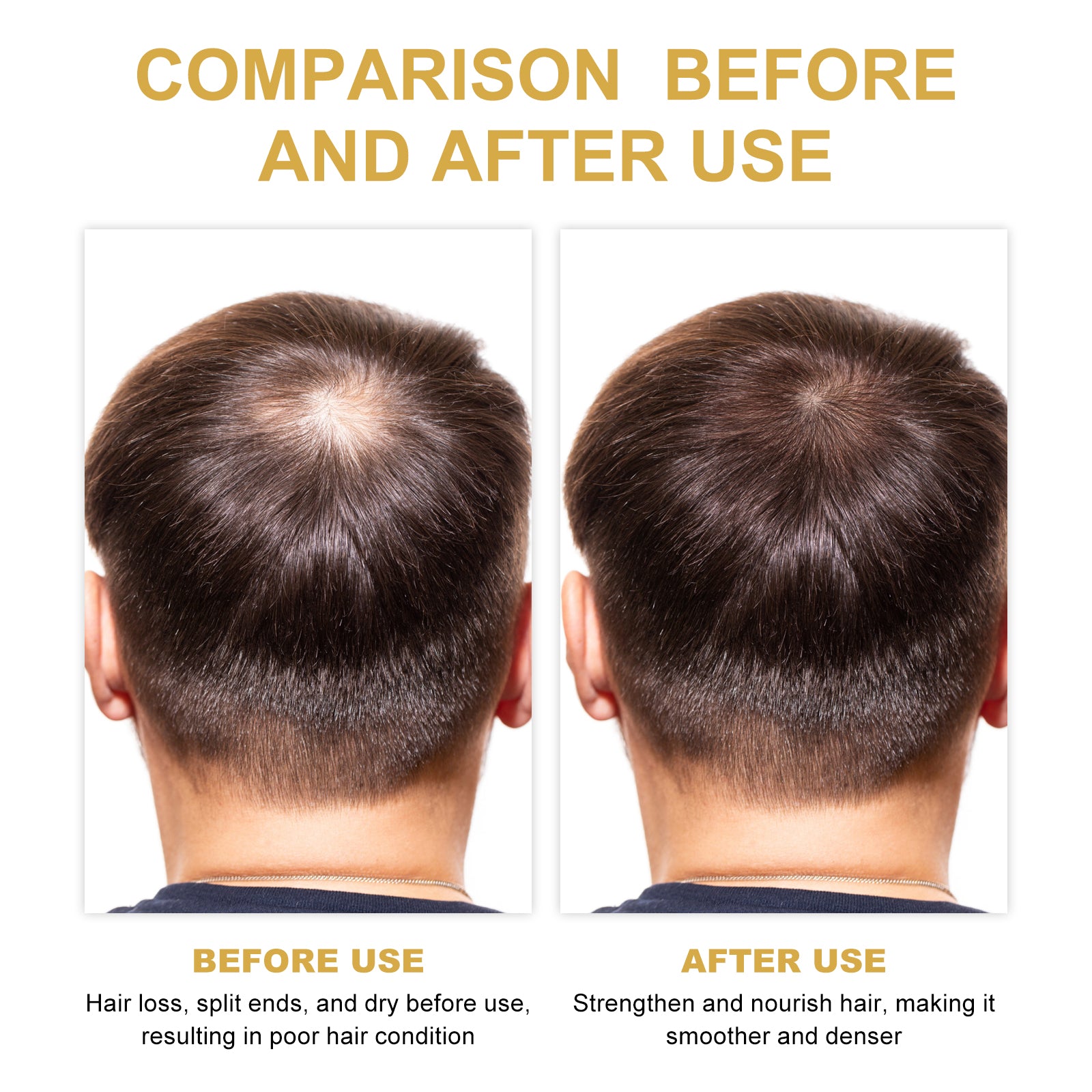 EELHOE Rosemary Hair Oil - Growth & Scalp Treatment (30ml)