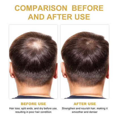 EELHOE Rosemary Hair Oil - Growth & Scalp Treatment (30ml) EELHOE Rosemary Hair Treatment Oil Scalp | Ectron Online