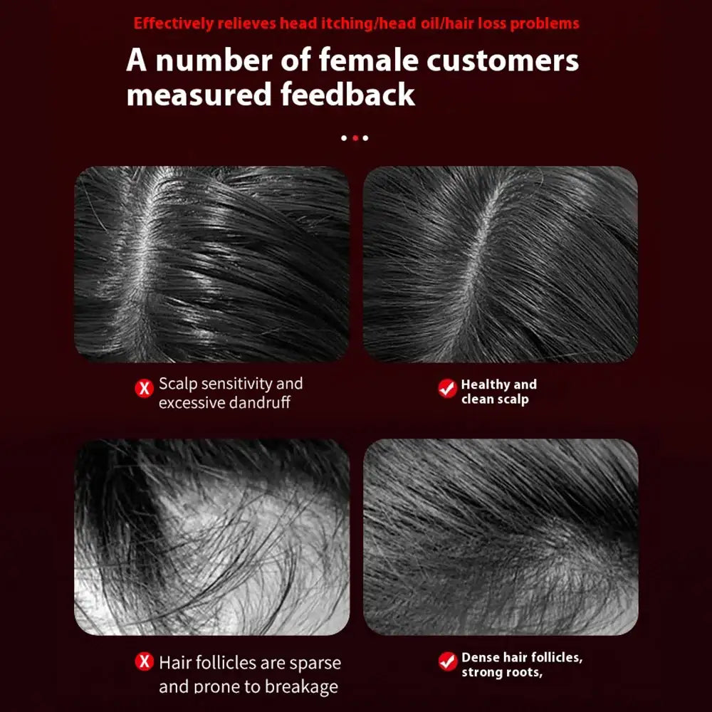 Electric Vibration Massage Comb Portable Hair Follicle Comb Scalp Oil Liquid Applicator Head Massager Hair Growth Anti Loss Care - Ectron Online