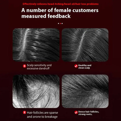 Electric Vibration Massage Comb Portable Hair Follicle Comb Scalp Oil Liquid Applicator Head Massager Hair Growth Anti Loss Care - Ectron Online