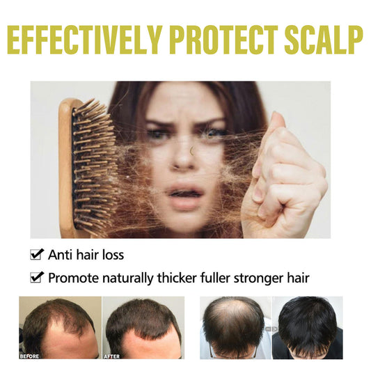 Product advertisement showing a woman with hair loss issues and claims of scalp protection and hair growth.