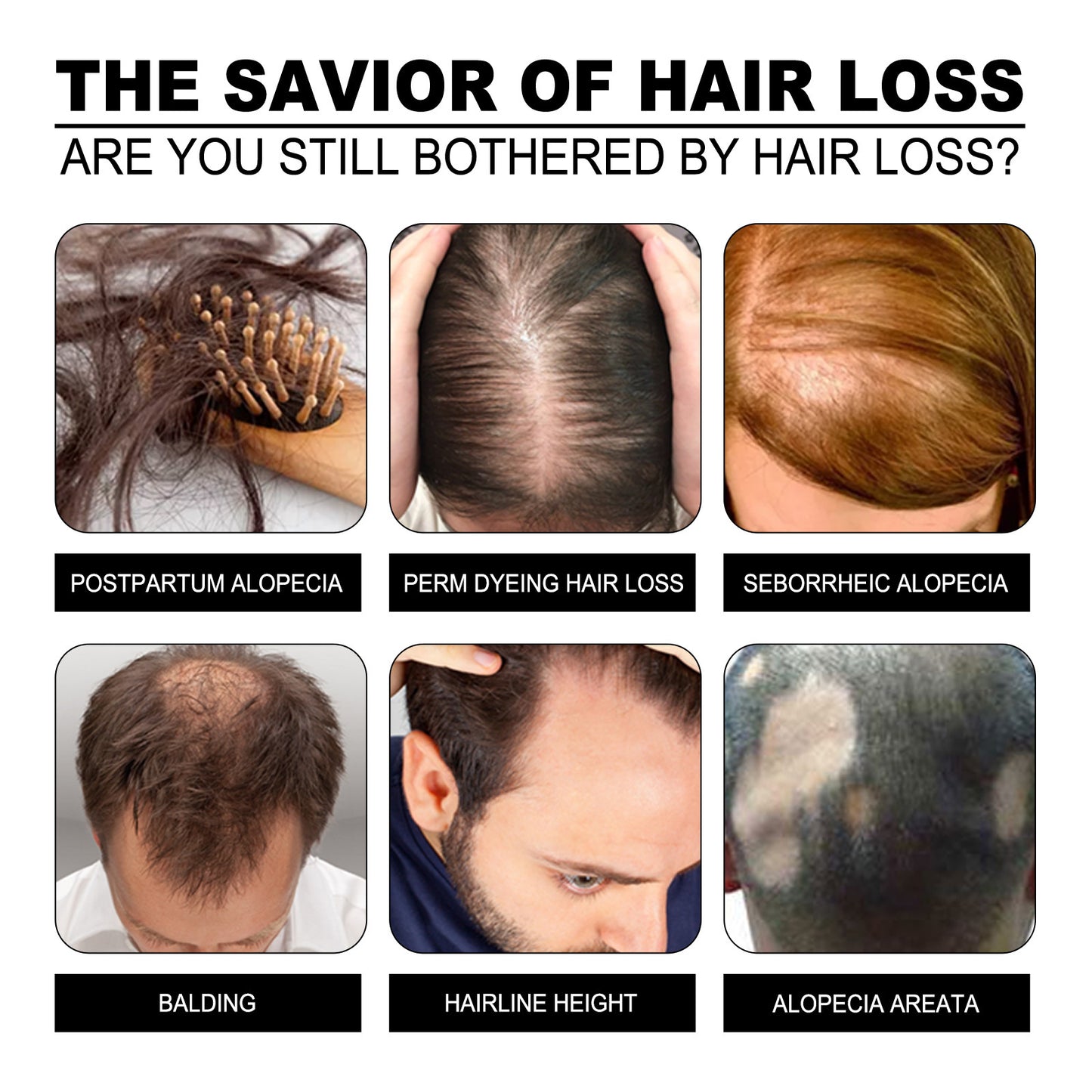 Promotional graphic about hair loss solutions with images of different types of hair loss.