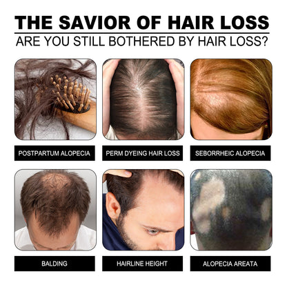 Promotional graphic about hair loss solutions with images of different types of hair loss.
