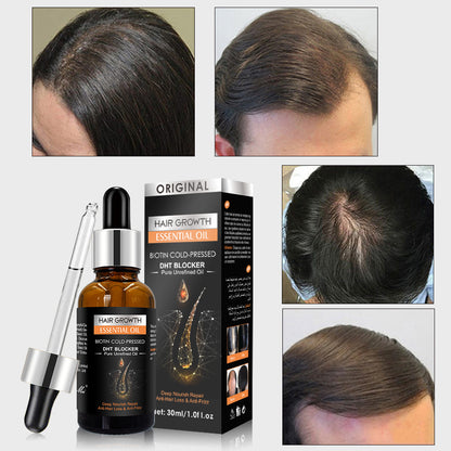 Hair growth essential oil with packaging and before-and-after hair health comparisons.