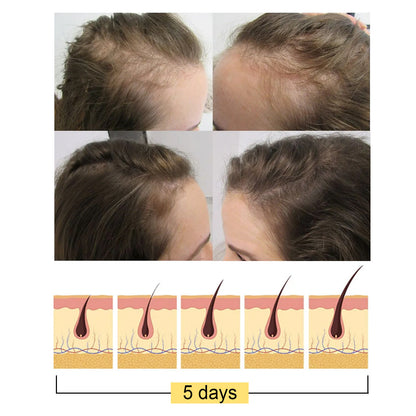 Before and after hair growth comparison with a diagram showing hair regrowth over 5 days.