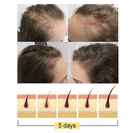 Before and after hair growth comparison with a diagram showing hair regrowth over 5 days.
