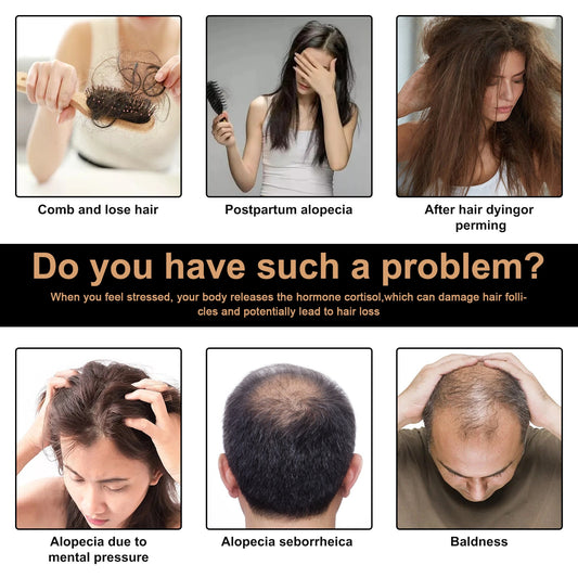 Illustration of hair issues including combing and losing hair, postpartum alopecia, hair dyeing and perming, alopecia due to mental pressure, alopecia seborrheica, and baldness.