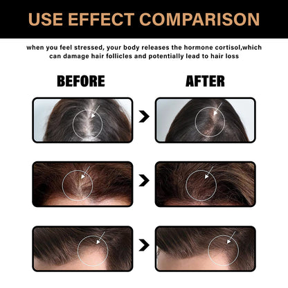 Before and after comparison of hair health with text explaining cortisol's effect on hair follicles.